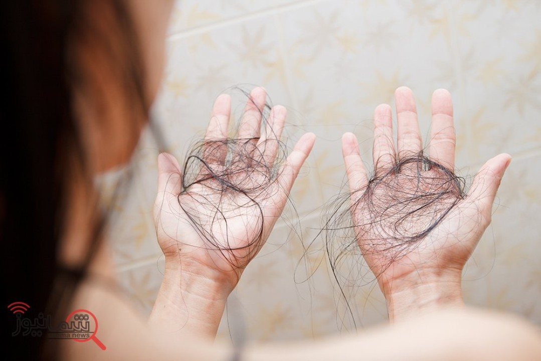 تعبیر خواب ریزش مو چیست | تعبیرخواب ریزش مو از نظر امام صادق (ع)
